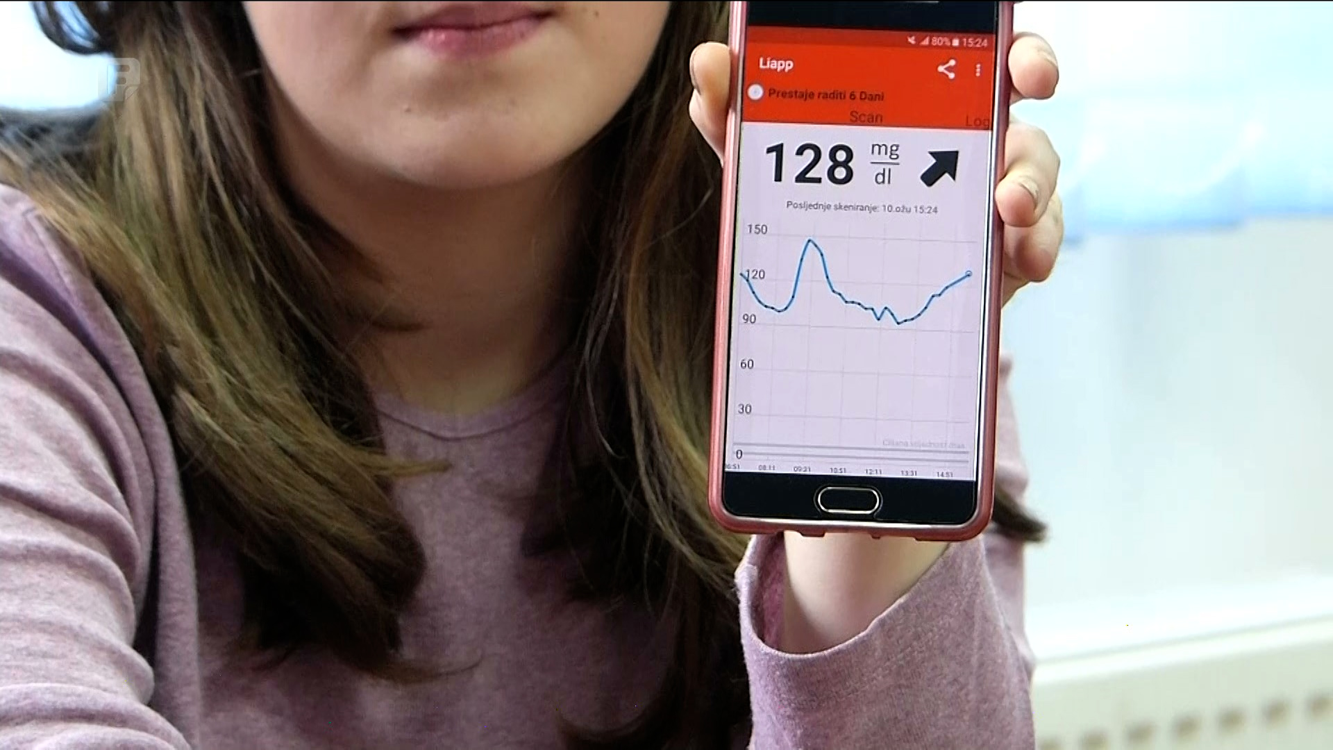 Zašto je obustavljena refundacija sredstava za nabavku senzora i čitača šećera u krvi?